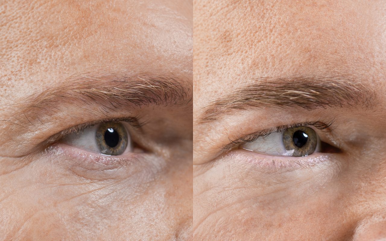 Permanent Make-Up Herren Augenbraue (Härchenzeichnung) direkt nach Pigmentierung 01 | Der Jungbrunnen Aichach