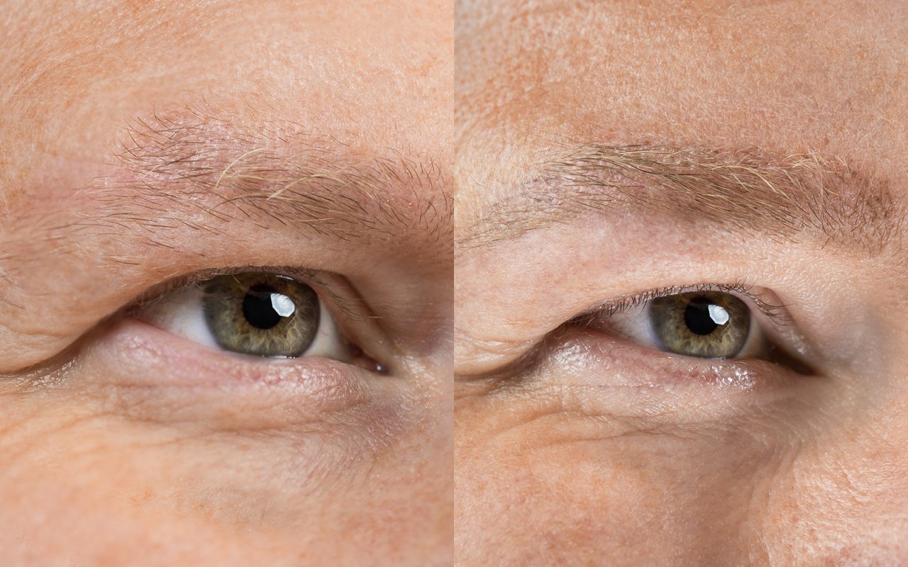 Permanent Make-Up Herren Augenbraue (Härchenzeichnung) direkt nach Pigmentierung 02 | Der Jungbrunnen Aichach